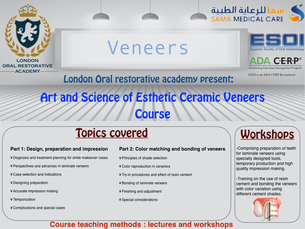 Art And Science Of Esthetic Ceramic Veneers